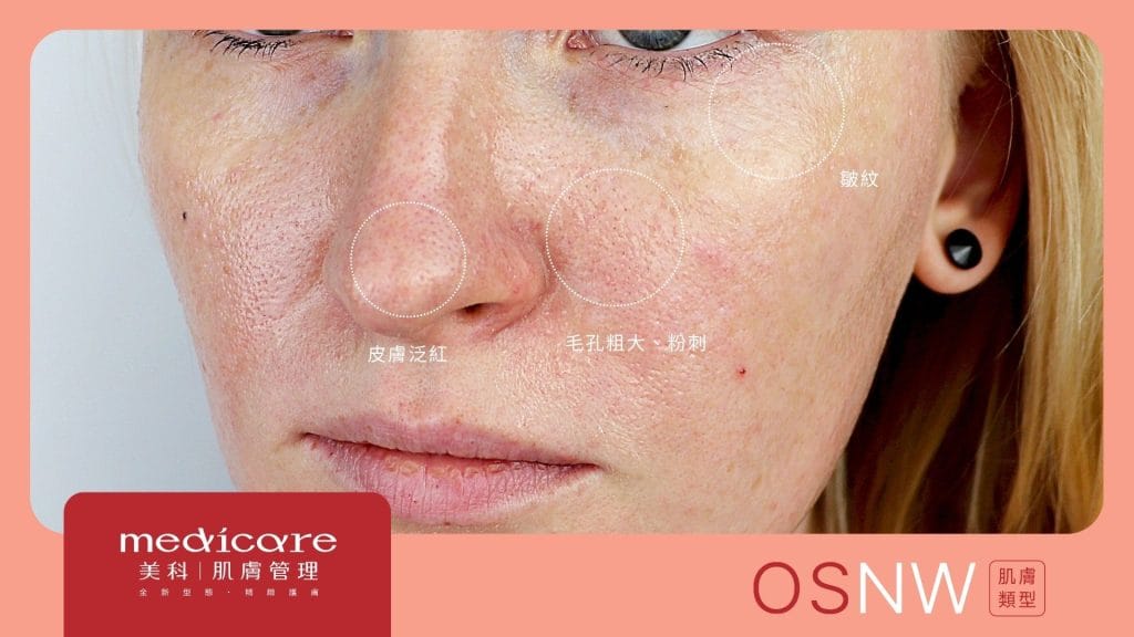 oil-sensitive-wrinkled