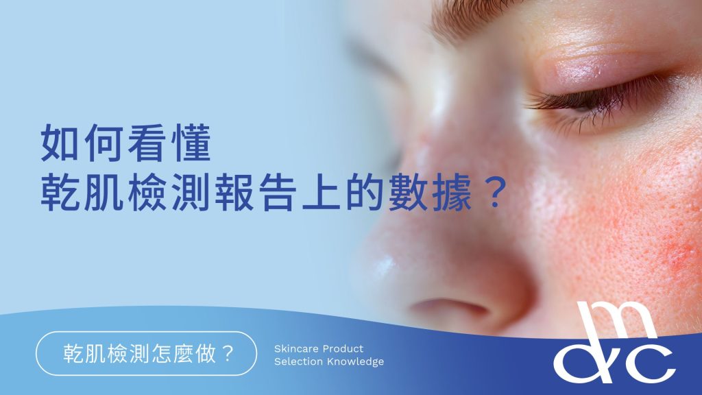 How to read the data on the report?