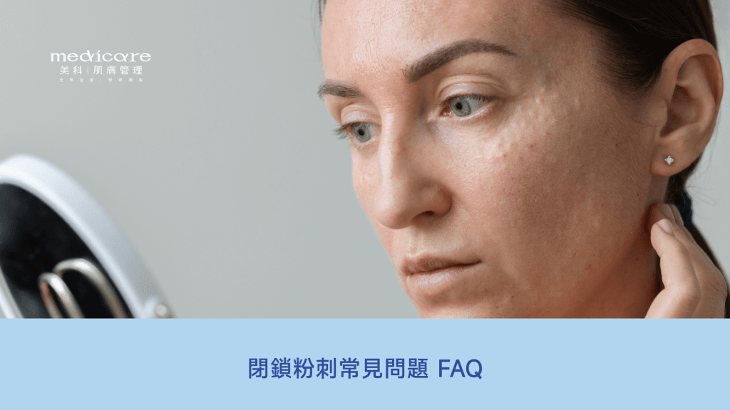 閉鎖性粉刺常見問題