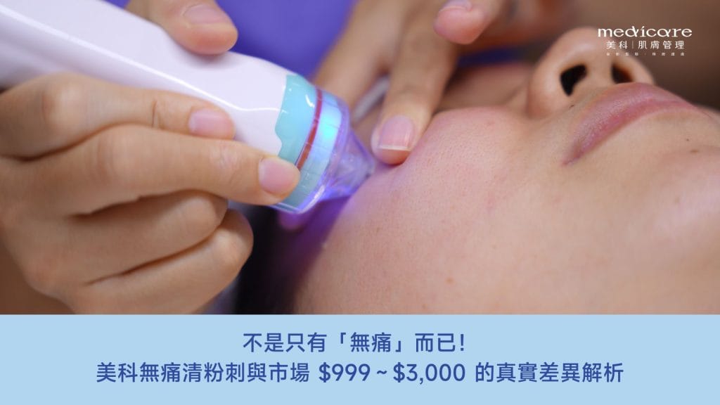 清粉刺的價格差異