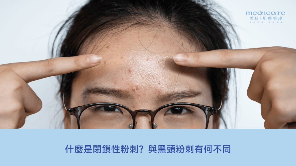 什麼是閉鎖性粉刺