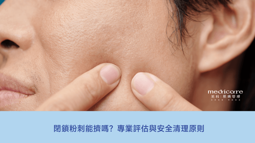 閉鎖性粉刺能擠嗎