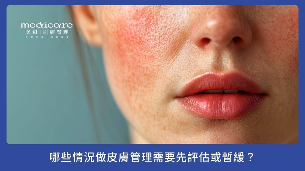哪些情況做皮膚管理需要先評估或暫緩?