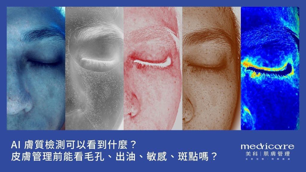 AI 膚質檢測可以看到什麼?