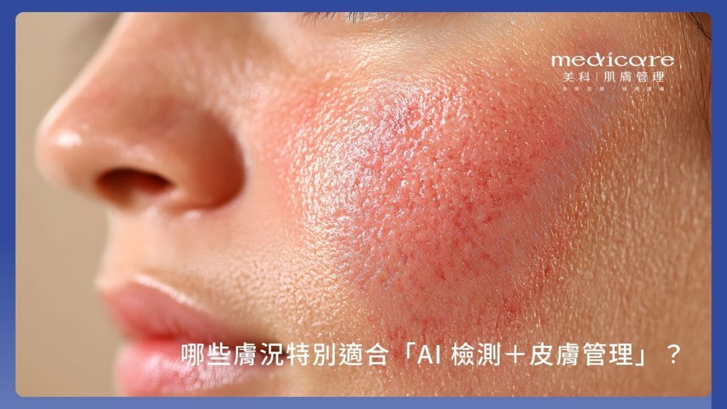 哪些膚況特別適合膚質檢測