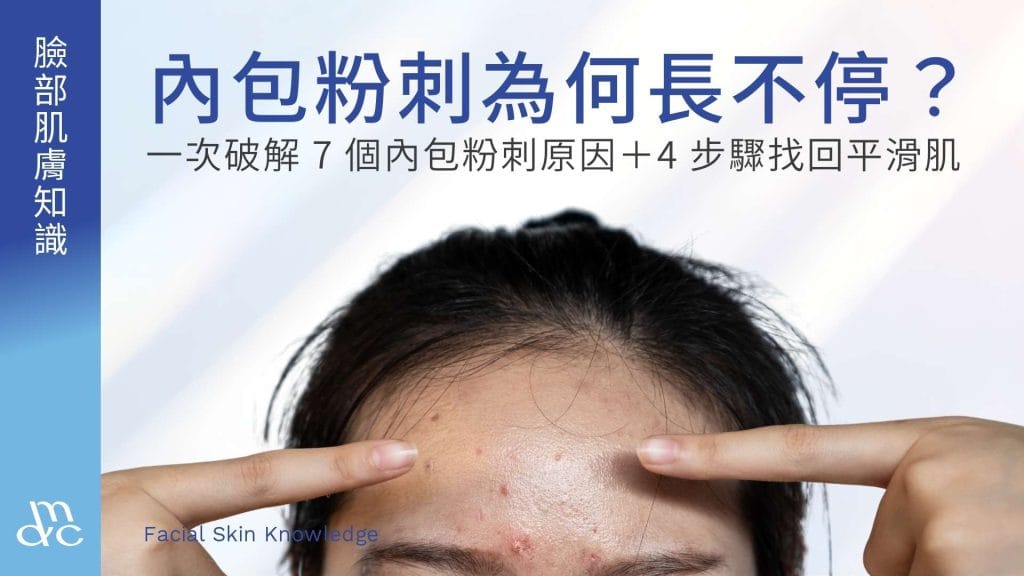 內包粉刺為何長不停?