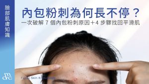 內包粉刺為何長不停?