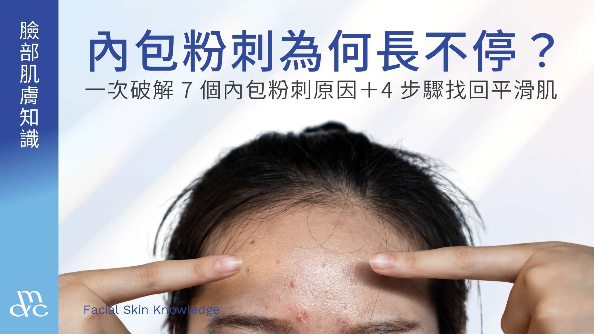 內包粉刺為何長不停?