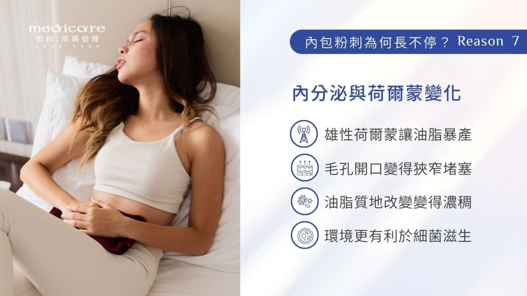 內包粉刺為何長不停?原因 7:內分泌與荷爾蒙變化