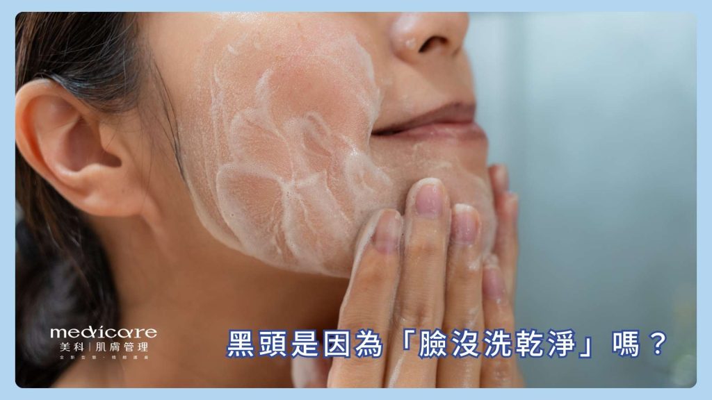 常見迷思:黑頭是因為「臉沒洗乾淨」嗎?