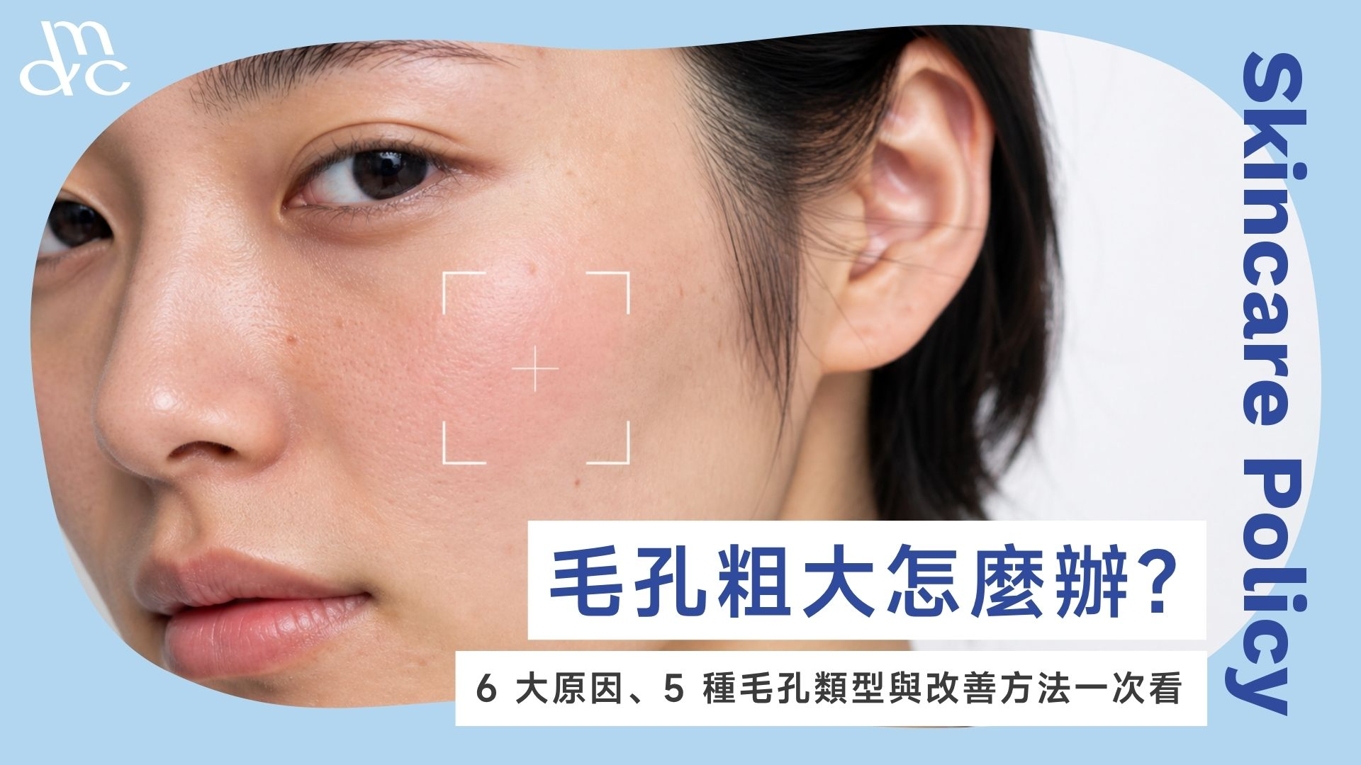 毛孔粗大怎麼辦？