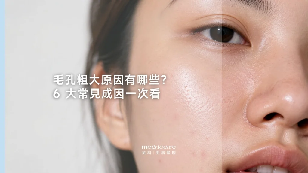 毛孔粗大原因