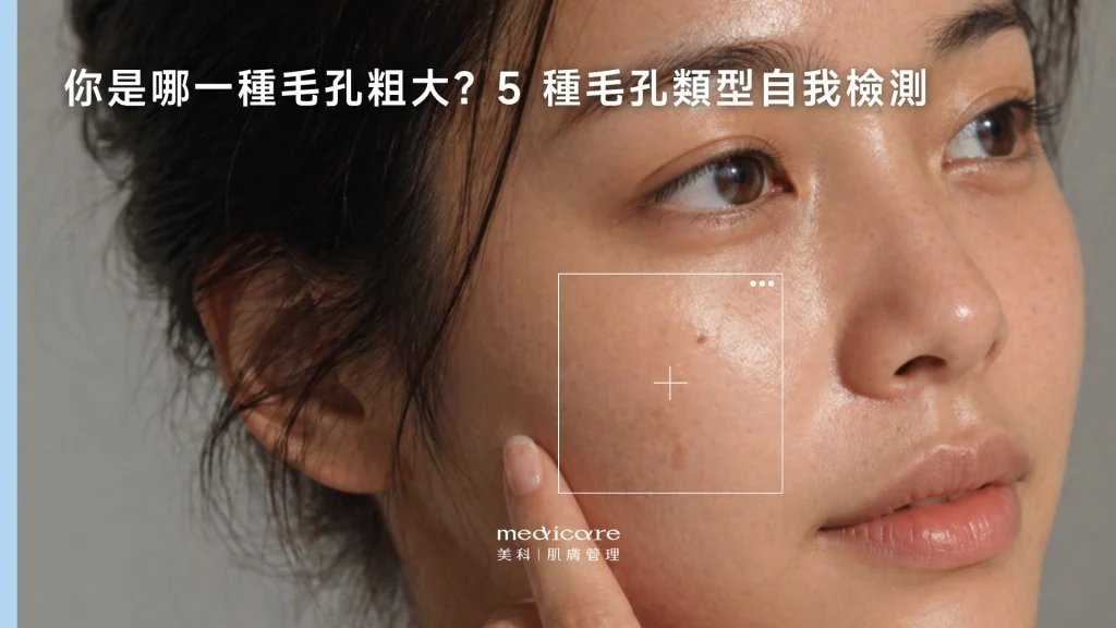 你是哪種毛孔粗大