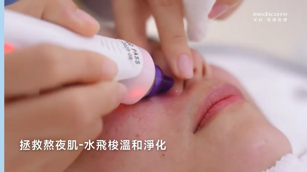 水飛梭溫和淨化