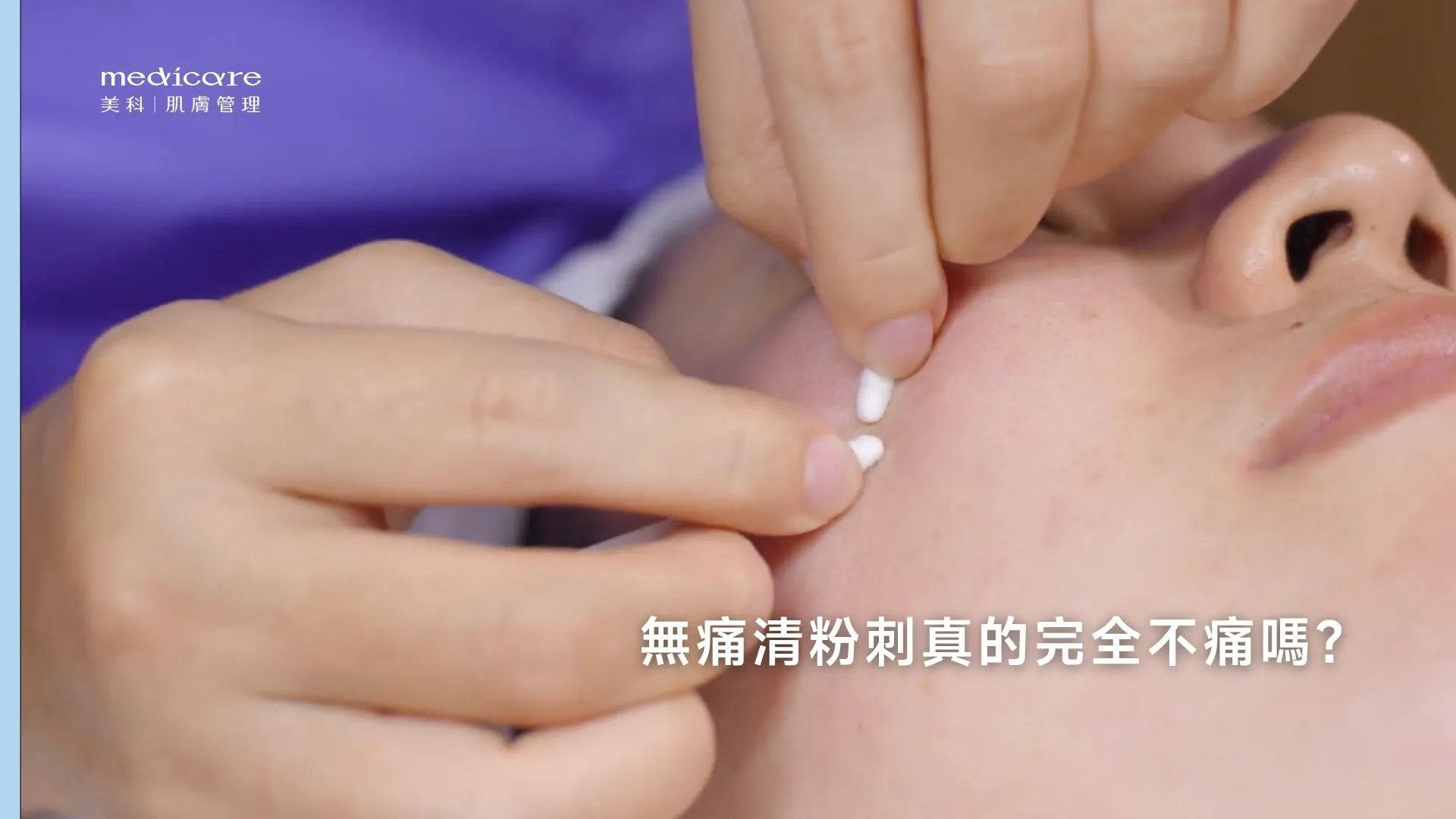 無痛清粉刺真的完全不痛嗎?